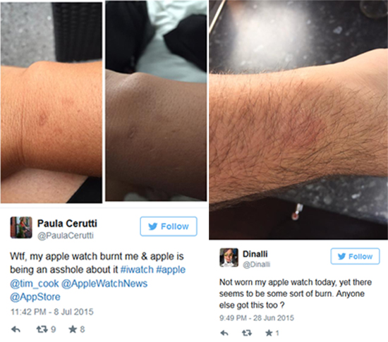 Apple Watch也过热：导致用户皮肤灼伤