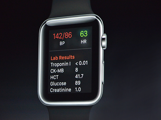 Apple Watch 2配置及功能的八大预测