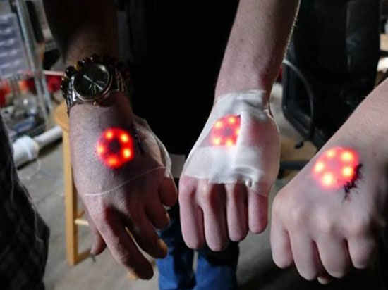 为了酷，黑客竟往自己身体中移植LED灯！